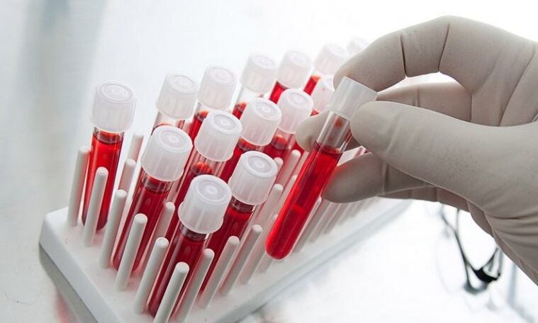 Used to analyze blood in test tubes of dogs with prostatitis