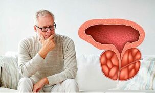 A person suffers from chronic prostatitis